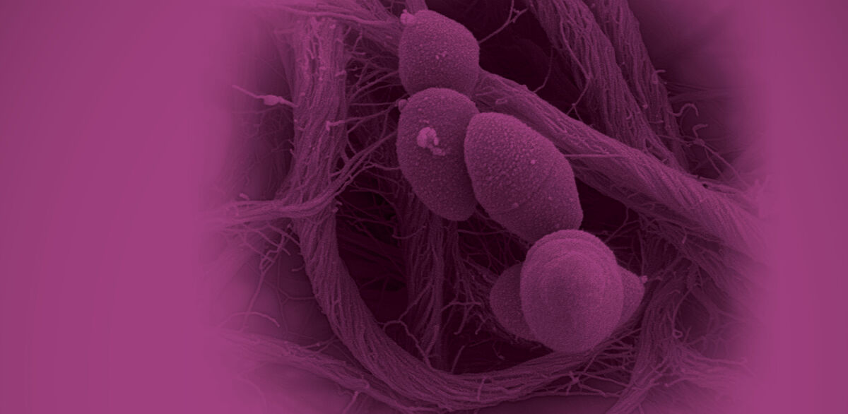 Post-translational modifications
